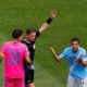 Guardiola Questions Red Card Decision Against Lewis